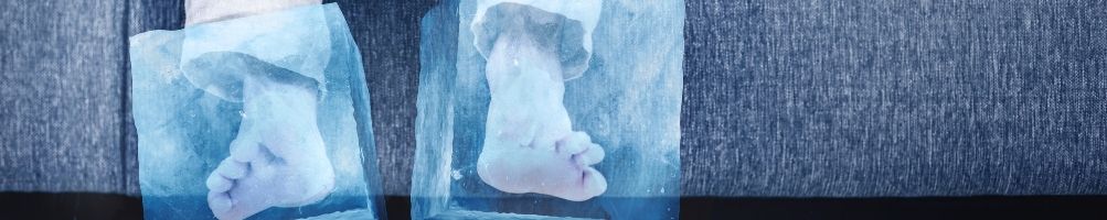 Piedi freddi